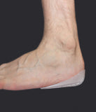12pc Heel Grip Kit
